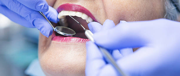 Best Emergency Root Canal Therapy in Saks, AL
